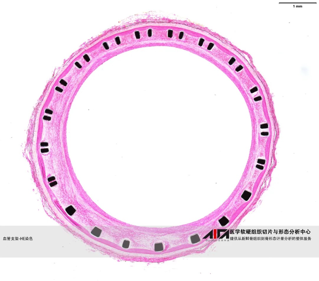【技术问答 十】硬组织制片与定性、定量分析-血管支架篇