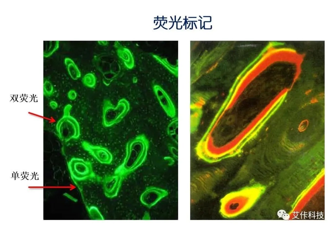 【技术问答 十二】骨形态计量分析-骨折模型篇