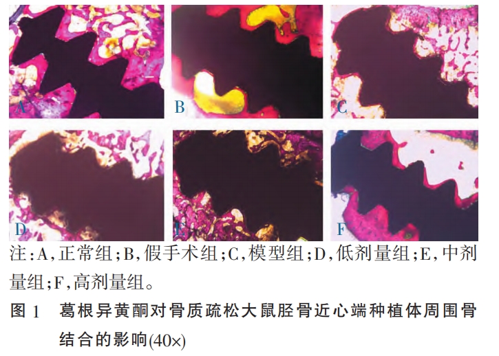【文章荐读】葛根异黄酮对骨质疏松状态下种植体周围骨结合的影响